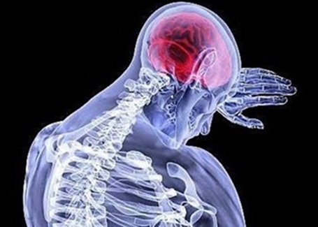 Módulo de Dolor Neuropático